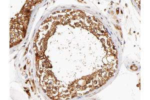 ABIN6266784 at 1/100 staining human testis tissue sections by IHC-P. (DCLK3 Antikörper)