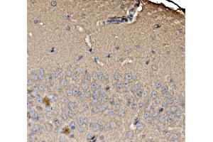 IHC analysis of SRP72 using anti-SRP72 antibody (ABIN7601648). (SRP72 Antikörper  (AA 40-460))