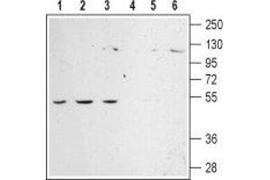 Western Blotting (WB) image for anti-Adrenergic, alpha-2C-, Receptor (ADRA2C) (AA 192-207), (C202S), (Extracellular) antibody (ABIN7042901)