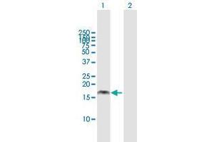 Western Blot analysis of PMAIP1 expression in transfected 293T cell line by PMAIP1 MaxPab polyclonal antibody. (NOXA Antikörper  (AA 1-136))