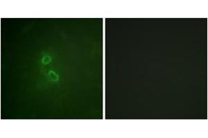 Immunofluorescence analysis of COS7 cells, using CD227/MUC1 (Ab-1229) Antibody. (MUC1 Antikörper  (AA 1201-1250))