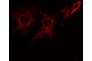 ABIN6266883 staining HeLa cells by IF/ICC. (ITPK1 Antikörper  (Internal Region))