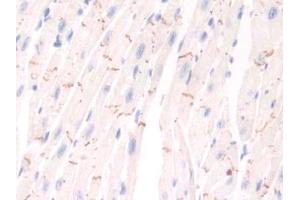 IHC-P analysis of Mouse Cardiac Muscle Tissue, with DAB staining. (PIM1 Antikörper  (AA 122-261))