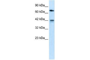 CACNB1 antibody used at 1 ug/ml to detect target protein. (CACNB1 Antikörper  (N-Term))