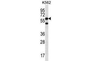 CCT8 Antibody (C-term) western blot analysis in K562 cell line lysates (35µg/lane).