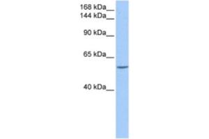 Western Blotting (WB) image for anti-Deleted in Liver Cancer 1 (DLC1) antibody (ABIN2463497) (DLC1 Antikörper)