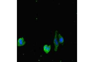 Immunofluorescent analysis of HepG2 cells using ABIN7149587 at dilution of 1:100 and Alexa Fluor 488-congugated AffiniPure Goat Anti-Rabbit IgG(H+L) (DOCK3 Antikörper  (AA 1630-1934))
