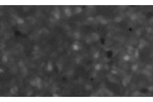 Image of the maximum plot of the fluorescence intensity (F/F0) of a Fluo3-stained culture of SiMa human neuroblastoma cells pretreated for 12 h with 10 μg/ml of α-CJe, and subsequently perfused for 50 s with 10 nmol/l of ACh in standard bath solution. (Campylobacter jejuni Antikörper)