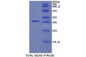 SDS-PAGE analysis of Rat Spondin 2 Protein. (SPON2 Protein)