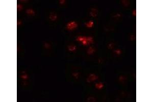 Immunofluorescence of TSHZ2 in A20 cells with TSHZ2 antibody at 20 µg/ml. (TSHZ2 Antikörper  (N-Term))