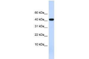 AGT antibody used at 1 ug/ml to detect target protein. (AGT Antikörper)
