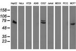 Western blot analysis of extracts (35 µg) from 9 different cell lines by using anti-SAMHD1 monoclonal antibody. (SAMHD1 Antikörper)