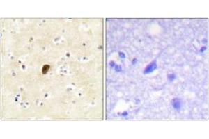 Immunohistochemistry analysis of paraffin-embedded human brain, using GluR4 (Phospho-Ser862) Antibody. (GRIA4 Antikörper  (pSer862))
