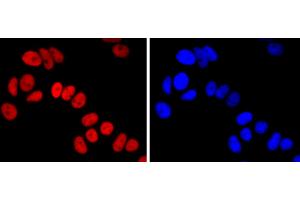 MCF-7 cells were stained with FOXA1 (5F7) Monoclonal Antibody  at 1:200 dilution, incubated overnight at 4C, followed by secondary antibody incubation, DAPI staining of the nuclei and detection.