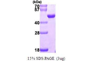 SDS-PAGE (SDS) image for Nudix (Nucleoside Diphosphate Linked Moiety X)-Type Motif 9 (NUDT9) (AA 47-350) protein (His tag) (ABIN667452)