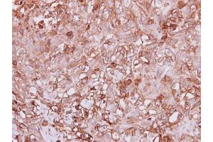 IHC-P Image Immunohistochemical analysis of paraffin-embedded DU145 xenograft, using Angiopoietin 4, antibody at 1:100 dilution. (Angiopoietin 4 Antikörper  (N-Term))