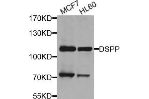 Western blot analysis of extracts of various cell lines, using DSPP antibody. (DSPP Antikörper)