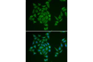 Immunofluorescence analysis of HeLa cells using AMPD3 antibody (ABIN6290008). (AMPD3 Antikörper)