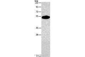 Western blot analysis of Mouse heart tissue, using SMAD9 Polyclonal Antibody at dilution of 1:290 (SMAD9 Antikörper)