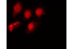ABIN6267694 staining NIH-3T3 by IF/ICC. (HDAC6 Antikörper  (pSer22))