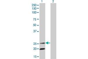 Western Blot analysis of IL6 expression in transfected 293T cell line by IL6 monoclonal antibody (M04), clone 3G6. (IL-6 Antikörper  (AA 29-212))