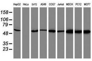 Image no. 1 for anti-V-Akt Murine Thymoma Viral Oncogene Homolog 1 (AKT1) antibody (ABIN1496557) (AKT1 Antikörper)