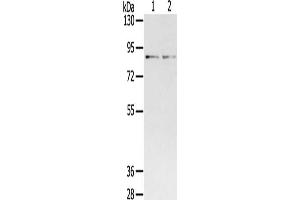 Gel: 6 % SDS-PAGE, Lysate: 40 μg, Lane 1-2: Mouse brain tissue, Mouse lung tissue, Primary antibody: ABIN7192633(SPON1 Antibody) at dilution 1/400, Secondary antibody: Goat anti rabbit IgG at 1/8000 dilution, Exposure time: 2 minutes (SPON1 Antikörper)