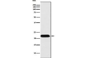 Western blot analysis of FTMT expression in HepG2 cell lysate.