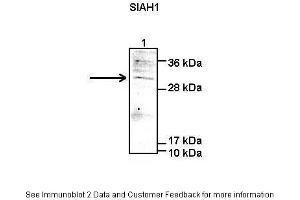 Lanes:   Lane1: 50 ug human HEK-293T lysate  Primary Antibody Dilution:   1:1000  Secondary Antibody:   Anti-rabbit-IgG  Secondary Antibody Dilution:   1:5000  Gene Name:   SIAH1  Submitted by:   Peter Brand & Dr. (SIAH1 Antikörper  (C-Term))