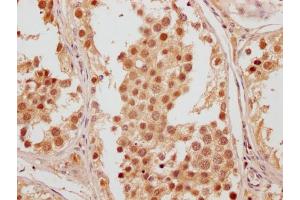 IHC image of ABIN7165518 diluted at 1:200 and staining in paraffin-embedded human testis tissue performed on a Leica BondTM system.