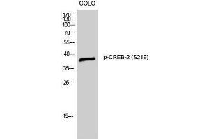 Western Blotting (WB) image for anti-Activating Transcription Factor 4 (Tax-Responsive Enhancer Element B67) (ATF4) (pSer219) antibody (ABIN3182392) (ATF4 Antikörper  (pSer219))