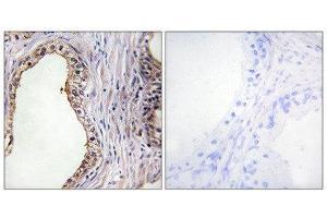 Immunohistochemistry (IHC) image for anti-Lecithin Retinol Acyltransferase (Phosphatidylcholine--Retinol O-Acyltransferase) (LRAT) (Internal Region) antibody (ABIN1849061) (LRAT Antikörper  (Internal Region))