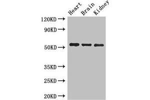 Western Blot Positive WB detected in: Mouse heart tissue, Mouse brain tissue, Mouse kidney tissue All lanes: SH3BP5 antibody at 3 μg/mL Secondary Goat polyclonal to rabbit IgG at 1/50000 dilution Predicted band size: 51, 33 kDa Observed band size: 51 kDa (SH3BP5 Antikörper  (AA 49-455))