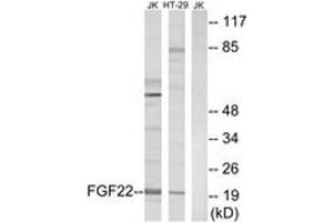 Western blot analysis of extracts from Jurkat/HT-29 cells, using FGF22 Antibody.