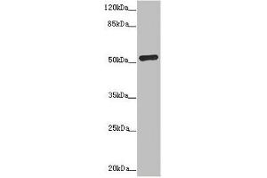 Western blot All lanes: ADPGK antibody at 1. (ADPGK Antikörper  (AA 218-497))