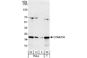 anti-COMM Domain Containing 4 (COMMD4) (AA 149-199) antibody