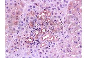Formalin-fixed and paraffin embedded rabbit cartilage tissue with Anti-Collagen IV Polyclonal Antibody, Unconjugated (ABIN728413) at 1:200, followed by conjugation to the secondary antibody and DAB staining (Collagen IV Antikörper  (AA 1401-1500))