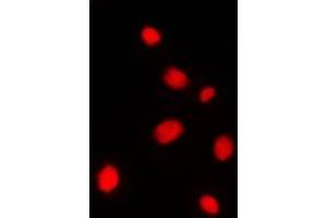 Immunofluorescent analysis of AKAP8 staining in Jurkat cells. (AKAP8 Antikörper  (Center))