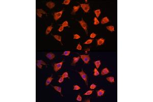 Immunofluorescence analysis of L929 cells using PFDN5 Rabbit pAb (ABIN1681328, ABIN3018415, ABIN3018416 and ABIN6220463) at dilution of 1:100 (40x lens). (PFDN5 Antikörper  (AA 1-154))