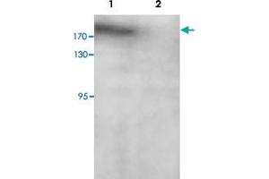 Western blot analysis of SK-OV-3 cell lysate with PARP14 polyclonal antibody  at 1 : 200 dilution. (PARP14 Antikörper  (C-Term))