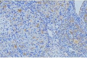 ABIN6269003 at 1/100 staining Human uterus tissue by IHC-P. (COL3A1 Antikörper  (N-Term))