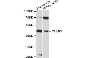 Western blot analysis of extracts of various cell lines, using CHMP7 antibody (ABIN6293246) at 1:3000 dilution.