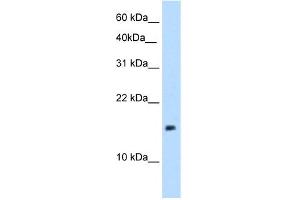 WB Suggested Anti-PAGE1 Antibody Titration:  5. (PAGE1 Antikörper  (Middle Region))