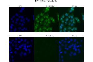 Sample Type :  HeLa   Primary Antibody Dilution:  4 ug/ml   Secondary Antibody :  Anti-rabbit Alexa 546   Secondary Antibody Dilution:  2 ug/ml   Gene Name :  PPP1R10 (PPP1R10 Antikörper  (N-Term))