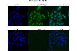 Sample Type :  HeLa   Primary Antibody Dilution:  4 ug/ml   Secondary Antibody :  Anti-rabbit Alexa 546   Secondary Antibody Dilution:  2 ug/ml   Gene Name :  PPP1R10