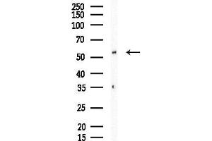 anti-Toll-Like Receptor Adaptor Molecule 1 (TICAM1) (Internal Region) antibody