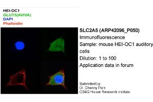 Image no. 2 for anti-Solute Carrier Family 2 (Facilitated Glucose/fructose Transporter), Member 5 (SLC2A5) (Middle Region) antibody (ABIN2777140) (SLC2A5 Antikörper  (Middle Region))
