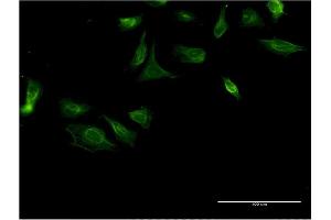 Immunofluorescence of monoclonal antibody to ITGA4 on HeLa cell. (ITGA4 Antikörper  (AA 98-207))