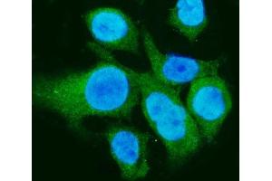 anti-Carbonic Anhydrase I (CA1) (AA 9-261) antibody