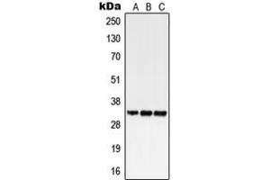 Western blot analysis of GPR18 expression in HEK293T (A), SP2/0 (B), H9C2 (C) whole cell lysates. (GPR18 Antikörper  (Center))